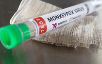 Ấn Độ nghiên cứu phát triển vắc-xin bệnh đậu mùa khỉ