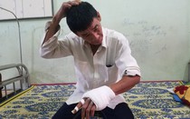 Phó trưởng công an xã bị tố dùng dao đánh vỡ xương bàn tay người dân