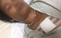 Vụ côn đồ cầm dao xông vào nhà chém người dân: Đến bệnh viện để truy sát