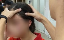 Hà Nội: Công an làm rõ vụ nữ sinh lớp 9 tố bị mẹ kế bạo hành dã man