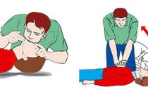 5 bước sơ cứu quyết định sự sống còn của người bị đuối nước