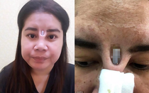 Mũi lồi silicone vì thẩm mỹ hỏng, phụ nữ xinh thành phim kinh dị