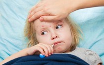 Những hiểm họa khôn lường khi cha mẹ không tiêm phòng sởi cho trẻ