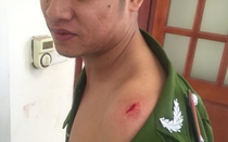 Khống chế đối tượng dùng rìu đe dọa người thân, chém công an