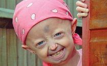 Xót xa bé gái 13 tuổi trong hình hài bà lão