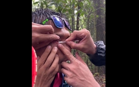 Mắt người đàn ông đau dữ dội, bạn bè lấy ra thứ "đáng sợ"