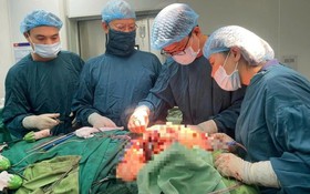 Phẫu thuật cứu sống cụ bà mang khối u máu khổng lồ trên mặt hơn 50 năm