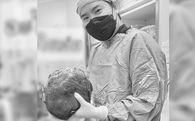 Bác sĩ sững người trước "thứ đáng sợ" trong bụng bệnh nhân