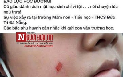 HS bị cô giáo cào rách má vì không ngủ trưa: Nhà trường lên tiếng