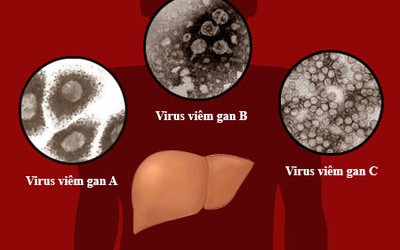 Những nguy hiểm khi bị viêm gan B, C, viêm túi mật