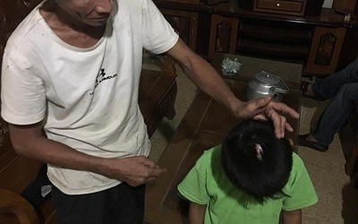Hà Tĩnh: Bé trai 6 tuổi bị cha đẻ thường xuyên bạo hành