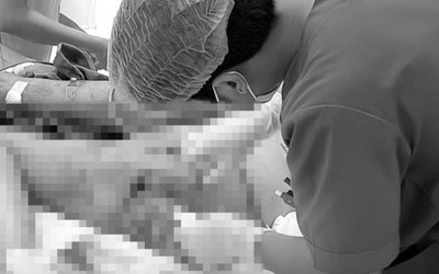 Cụ ông 76 tuổi sốc nhiễm khuẩn, hoại tử vùng đùi vì sai lầm phổ biến