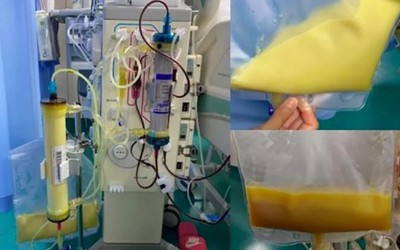 Người phụ nữ 27 tuổi "máu trắng đục" vì thường xuyên uống thứ nước vạn người mê