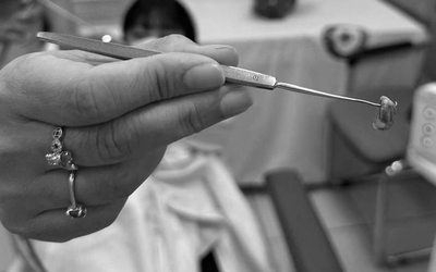 Bé 3 tuổi chảy nước mũi có mùi hôi khó chịu, bác sĩ gắp ra thứ "đáng sợ" bên trong
