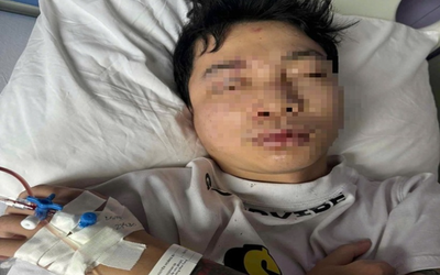 Điều tra vụ nam DJ bị tấn công tập thể giữa chốn đông người