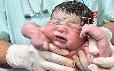 Bé trai chào đời cùng với vòng tránh thai của mẹ