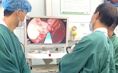 Chủ quan với cơn đau bụng, người đàn ông suýt đánh đổi bằng mạng sống