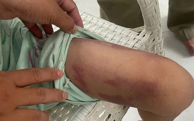 Vụ bé gái 9 tuổi bị bạo hành: Bắt tạm giam mẹ ruột và người tình