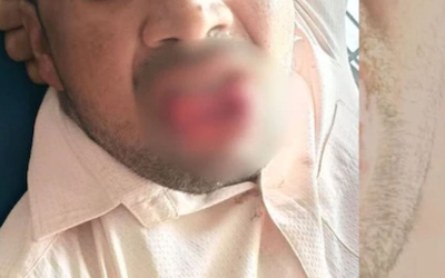 Bị quấy rối trên đường, cô gái đáp trả theo cách khiến kẻ tấn công choáng váng