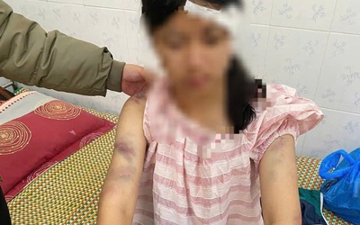 Bé gái 13 tuổi bị bà nội và 2 người ông đánh đập vì nghi trộm tiền