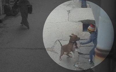 Đang chơi trên phố, cậu bé bị chó Pitbull tấn công