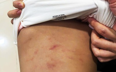 Bản tin 7/11: Làm rõ vụ cháu bé 2 tuổi nghi bị bạo hành tại lớp trông trẻ