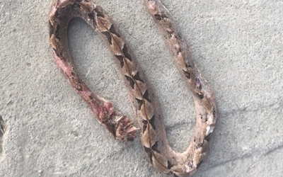 Người đàn ông 27 tuổi suýt mất mạng vì tự ý chữa bệnh theo “kiểu lạ đời"