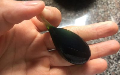 Người đàn ông 38 tuổi suýt chết vì nuốt mật cá trắm để "tăng cường sinh lực"