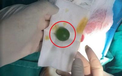 Bé 13 tháng liên tục nôn ói không rõ lý do, sự thật khiến bác sĩ lạnh sống lưng