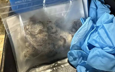 Nam 17 tuổi nguy kịch, phải cắt một phần phổi vì thói quen "gây nghiện" của giới trẻ