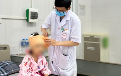 Chó nhà "nổi điên" tấn công, 2 người nhập viện khẩn cấp
