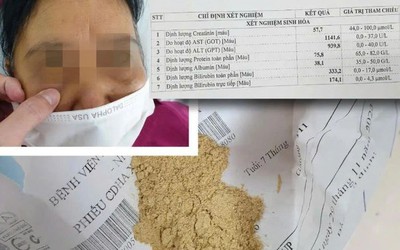 Uống thuốc mua qua mạng chứa "chất cấm", cụ bà bị suy thận cấp