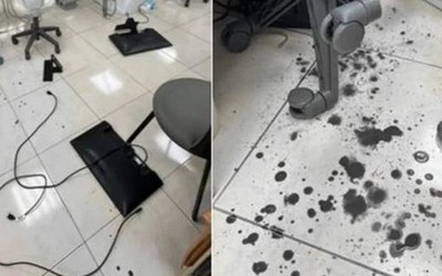 Phẫn nộ nam thanh niên 21 tuổi hành hung nữ nha sĩ suýt mù mắt