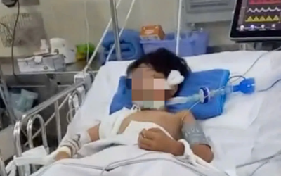 Dừng chờ đèn đỏ, bé trai 10 tuổi bị cành cây rơi trúng đầu dẫn tới nguy kịch