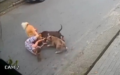Người phụ nữ dùng tay không chiến đấu với Pitbull để bảo vệ chó cưng