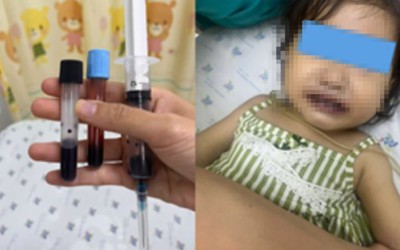 Ăn canh nấu bằng nước giếng, máu của bé gái 16 tuổi chuyển màu nâu đen