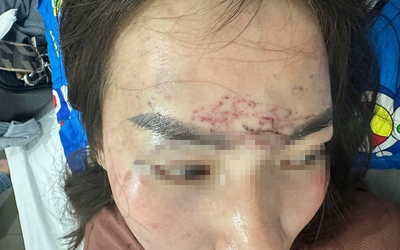 Diễn biến mới vụ người phụ nữ bị cắt tóc, xăm mặt ở Cà Mau