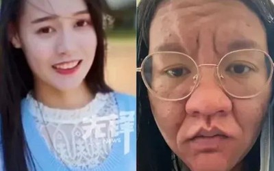 Người phụ nữ gây sốc vì gương mặt như bà lão khi mang thai