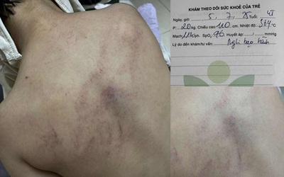 Vụ cháu bé 4 tuổi bị đánh, ném vào tường ở Hà Nội: Cô giáo bạo hành nói gì?