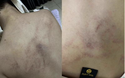 Đình chỉ cô giáo bị tố dốc ngược đầu trẻ, ném xuống giường ở Trường Mầm non Gia Thụy