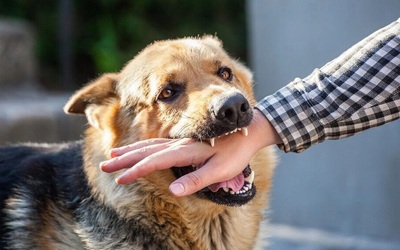Bé trai ở Đắk Lắk bị chó cắn nhiều lần nhưng không tiêm phòng, tử vong nghi do bệnh dại