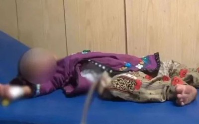 Bác sĩ sốc nặng khi phát hiện bé gái vừa chào đời đã "mang thai"