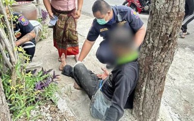 Lý do khiến người đàn ông 48 tuổi bị gai sầu riêng đâm đầy mặt