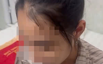 Dính bẫy lừa quen thuộc, nữ sinh tự thuê khách sạn rồi gọi cho mẹ nói bị bắt cóc