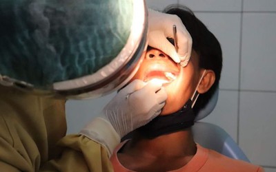Người đàn ông 35 tuổi bị cắt bỏ hàm khi đi nhổ răng khôn