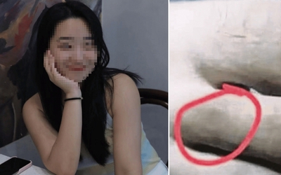 Đi bộ về khách sạn, cô gái 27 tuổi bị rắn cắn tử vong