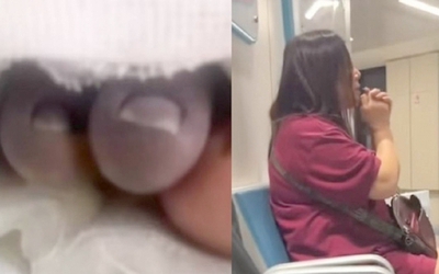 Bé trai 2 tuổi bất ngờ phát sốt, nguy cơ cắt bỏ bàn chân sau khi theo bà đi chợ
