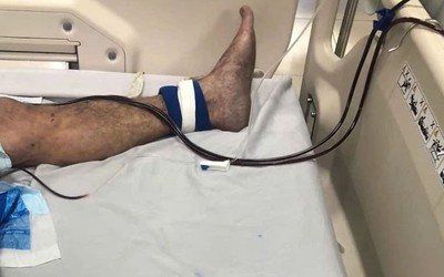 Tiếp xúc với loại thịt này, người đàn ông 61 tuổi suýt tử vong
