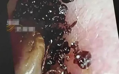 Bé gái 2 tuổi đi khám vì đau tai, bác sĩ phát hiện "bí mật đáng sợ"