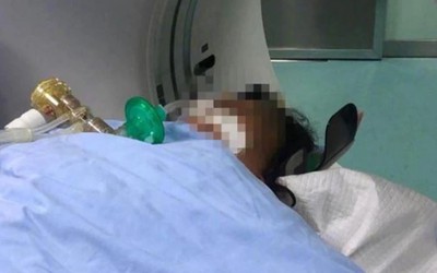 Loại rau chứa chất độc cực mạnh, 3 người trong một gia đình nguy kịch sau khi ăn